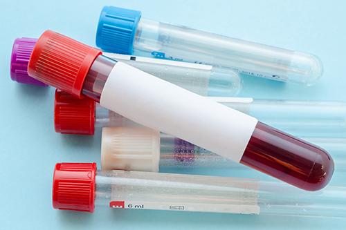 Interpretação Clínica de Hemograma e de Provas Hemostáticas - Para Farmacêuticos Interpretação Clínica de Hemograma e de Provas Hemostáticas - Para Farmacêuticos