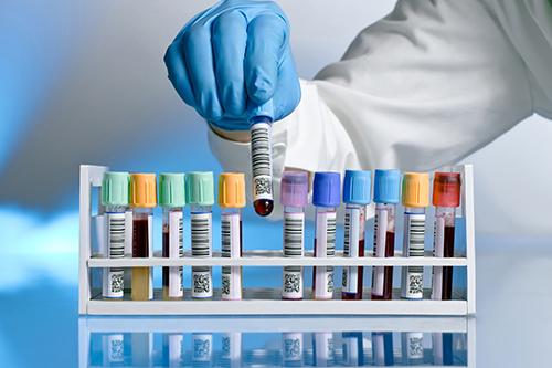 Interpretação Clínica de Provas de Função Renal e Equilíbrio Hidroeletrolítico Para Farmacêuticos Interpretação Clínica de Provas de Função Renal e Equilíbrio Hidroeletrolítico Para Farmacêuticos